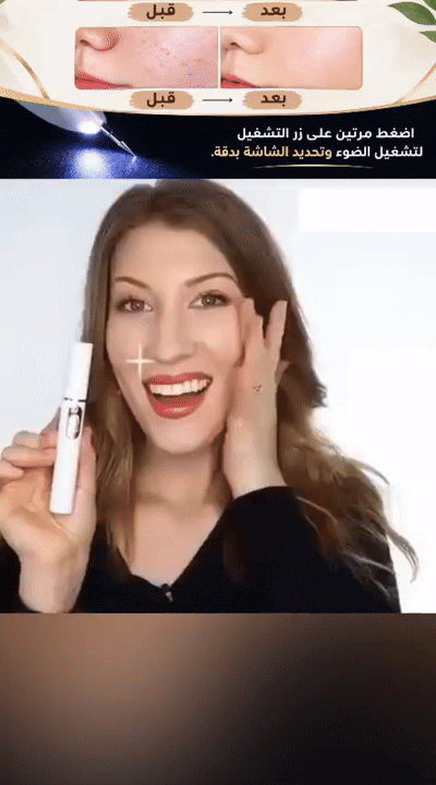 Xorita Plasma Pen – Professional Non-Invasive Skin Tag, Mole & Wart Remover